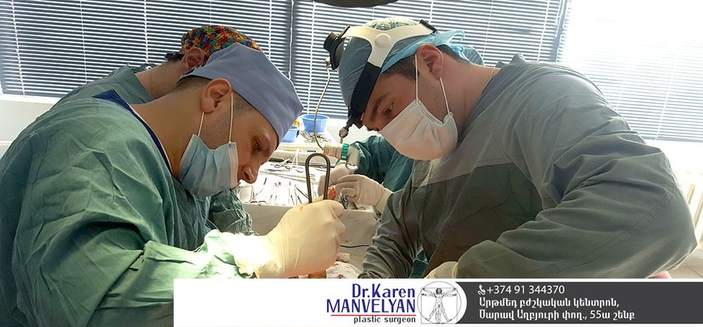 Եթե պլանավորում եք քթի պլաստիկ վիրահատություն. Խորհուրդներ մասնագետից