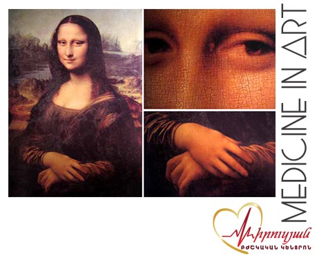 Դեռ չքննարկված բացահայտումներ Դա Վինչիի Մոնա Լիզա նկարում