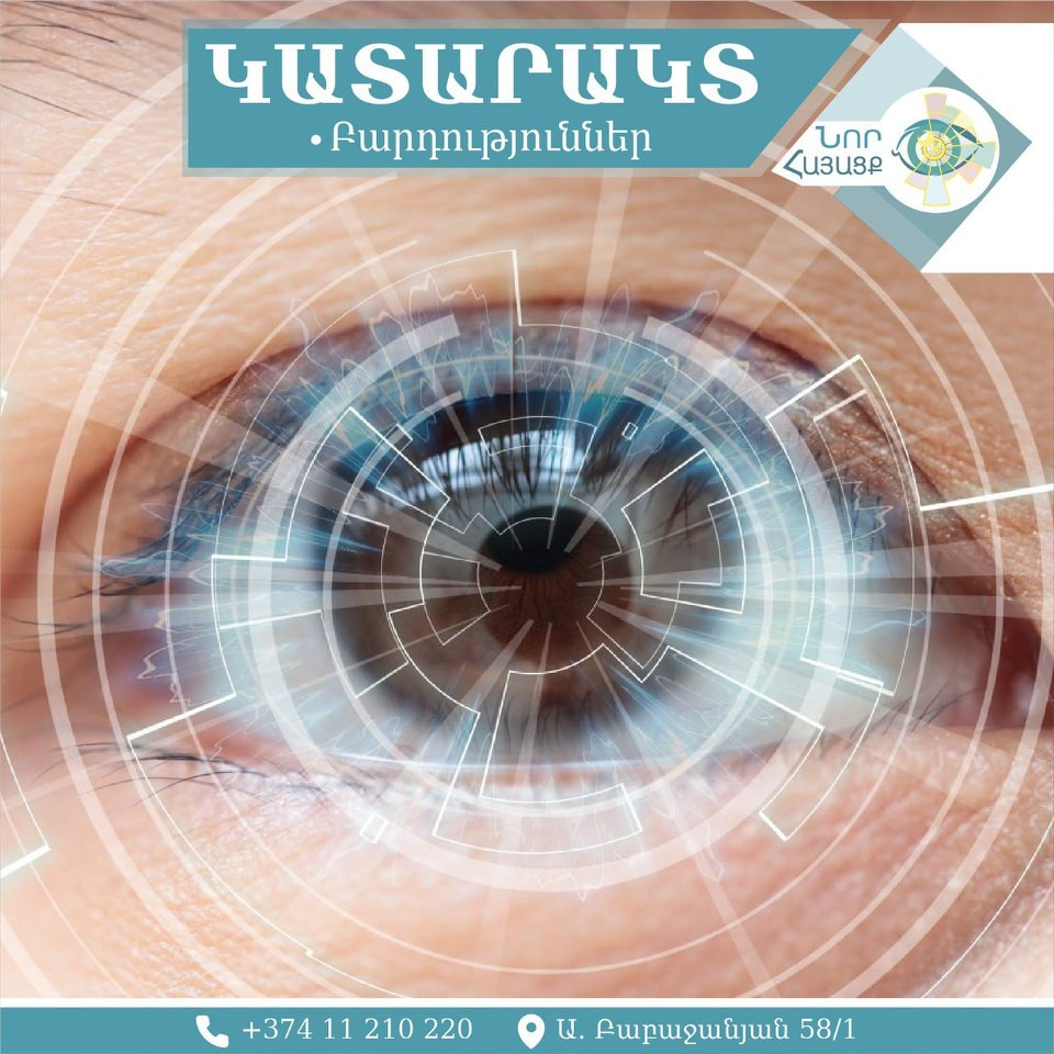 ԿԱՏԱՐԱԿՏԻ ԲԱՐԴՈՒԹՅՈՒՆՆԵՐԸ. ինչպիսին է բուժումը